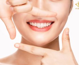 Mặt dán sứ Veneer – Phục hình thẩm mỹ bảo tổn hơn 90% răng thật
