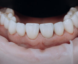 Cảnh báo hậu quả dịch vụ bọc răng sứ giá rẻ TPHCM