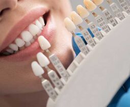 Bọc răng sứ màu nào đẹp – Bác sĩ chuyên gia hàng đầu tại nha khoa ST Dentist chia sẻ
