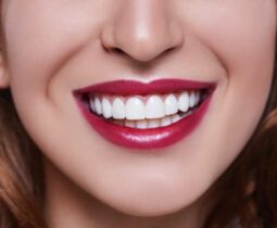 Dán phủ sứ răng sứ là gì? Những trường hợp nên dán phủ sứ răng sứ