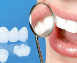 Giá răng sứ cao cấp có cao không?