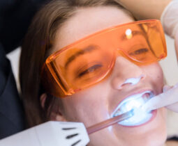Tẩy trắng răng – điểm nhanh một số thông tin bạn nên biết