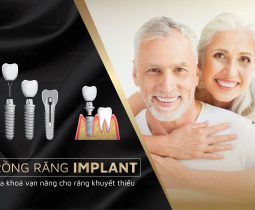 Cấy ghép Implant – An toàn – Chi phí hợp lí