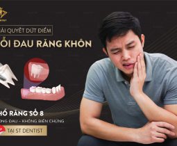 Nhổ răng không đau – Nhanh chóng – An toàn
